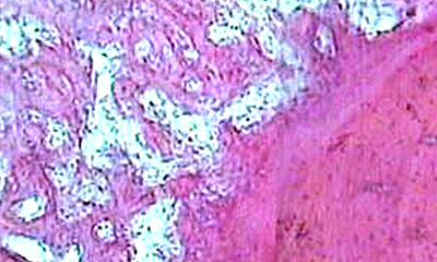 О стволовой (мезенхимальной) клетке