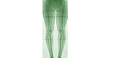 Косметична ортопедія