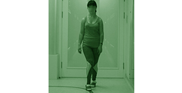 Коррекция нарушения функции ходьбы при ДЦП