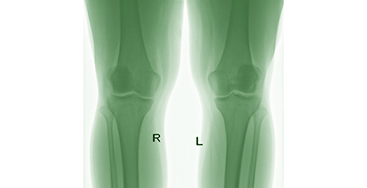 Пошкодження і захворювання колінного суглоба