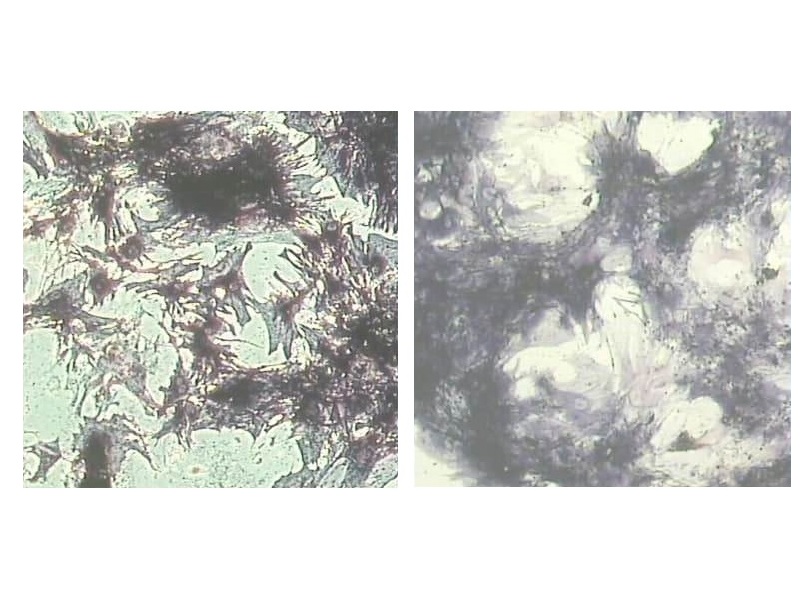 Морфо-функциональные изменения мезенхимальных стволовых клеток